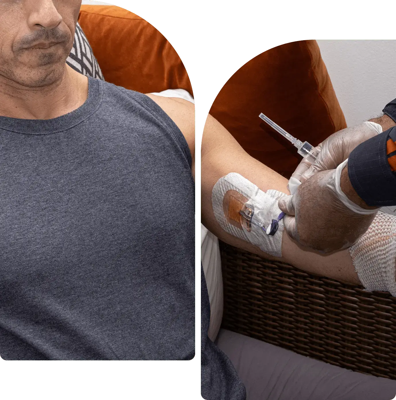 A provider offering an artificial skin graft to a patient.